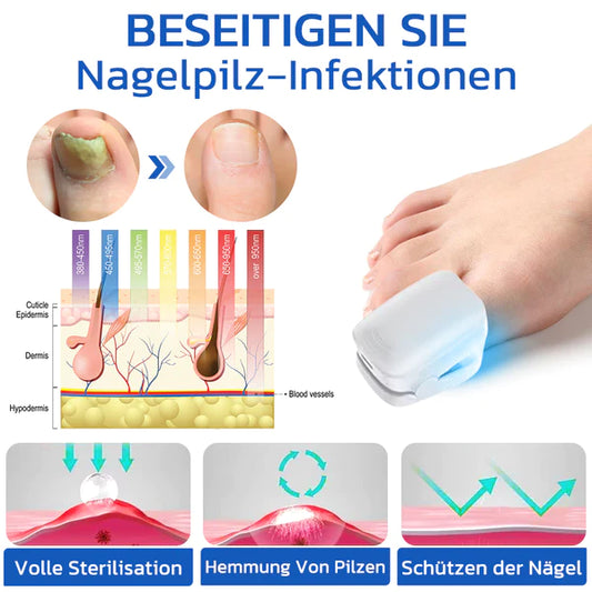 OrthoVital Mini gegen Nagelpilz