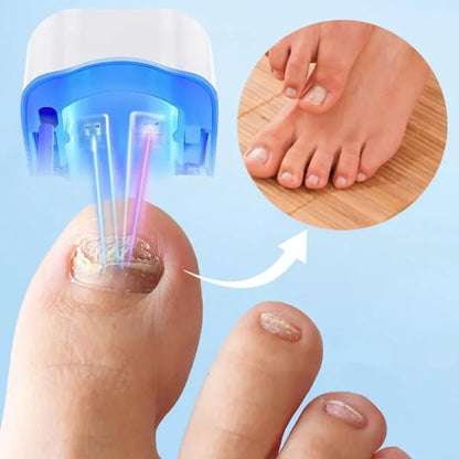 OrthoVital Mini gegen Nagelpilz