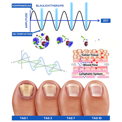 OrthoVital Mini gegen Nagelpilz