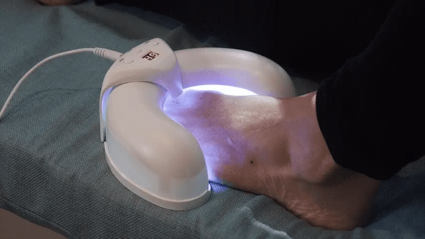 OrthoVital Mini gegen Nagelpilz